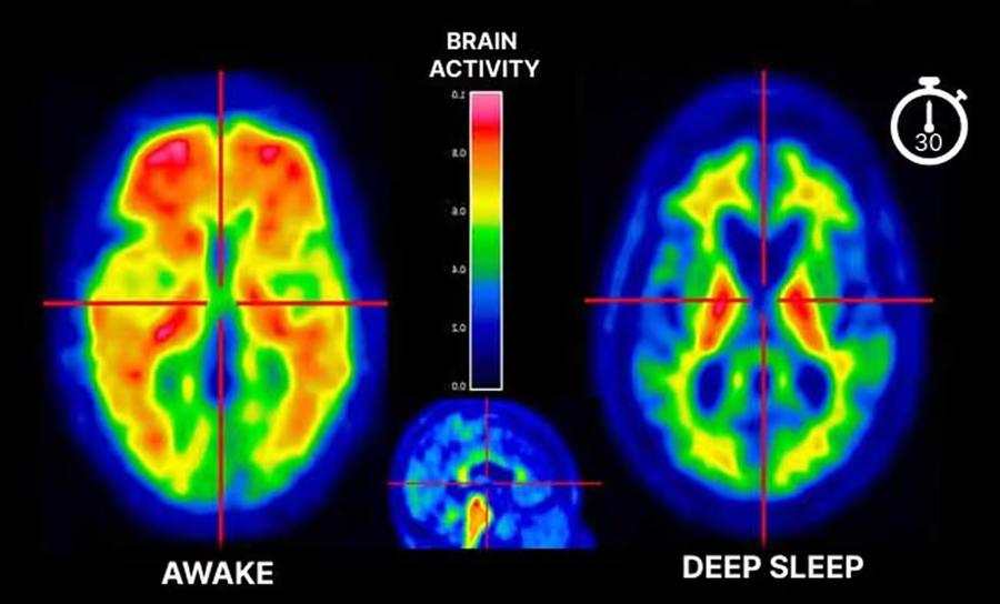 Brain activity awake versus deep sleep